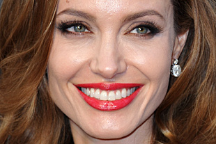 Angelina Jolie kezelésre szorul