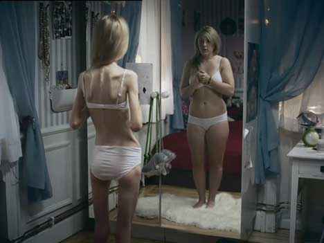 anorexiás fogyás előtt és után