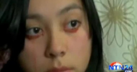 Bizarr! Vért sír egy chilei nő