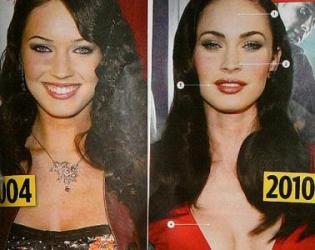 Megan Fox plasztikai műtéteken esett át?