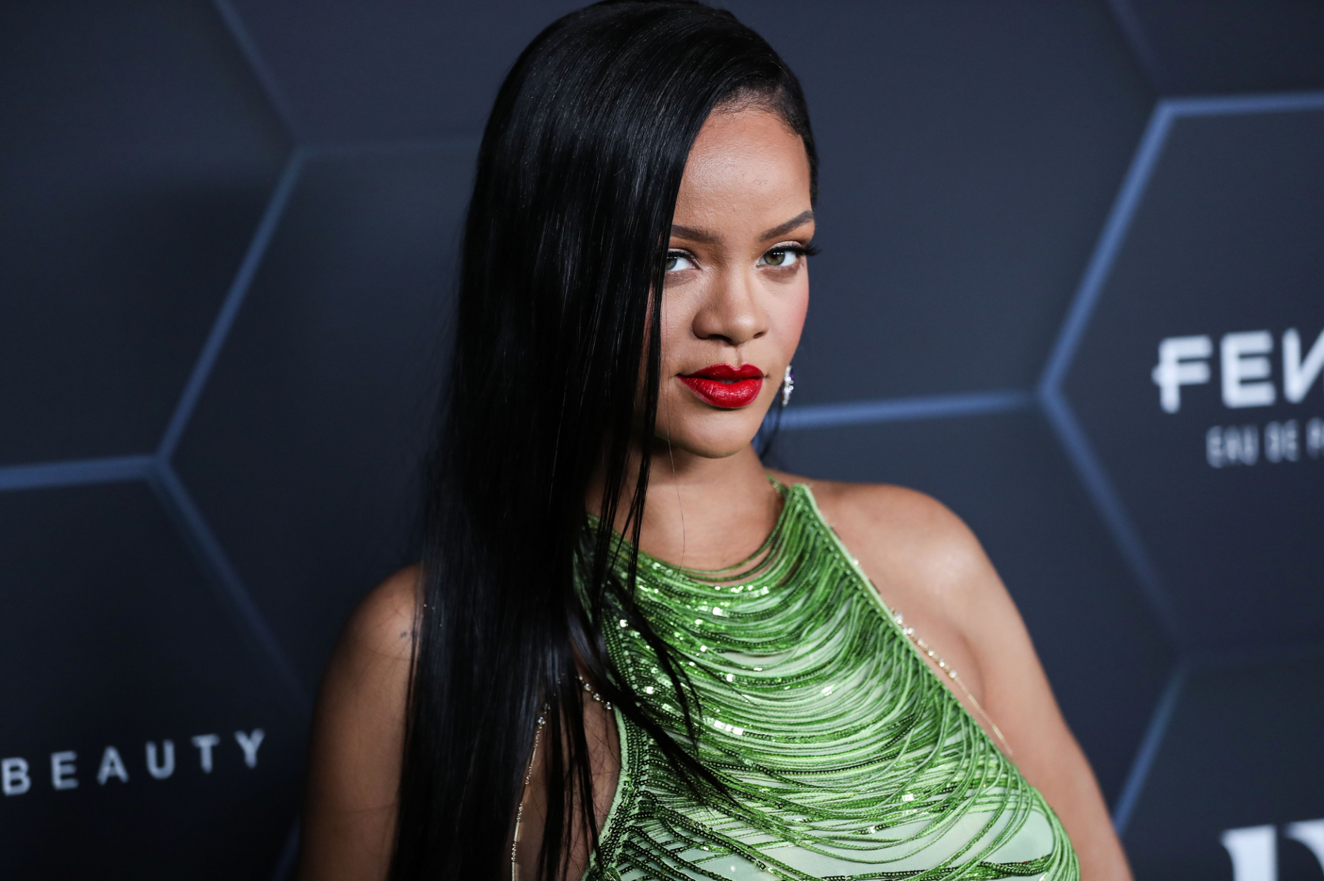 Rihanna felfedte azt a plasztikai sebészeti eljárást, amit igazán szeretne