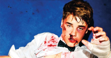 Véresre verték Justin Biebert